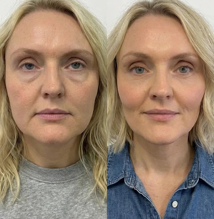 Caroline A, 44