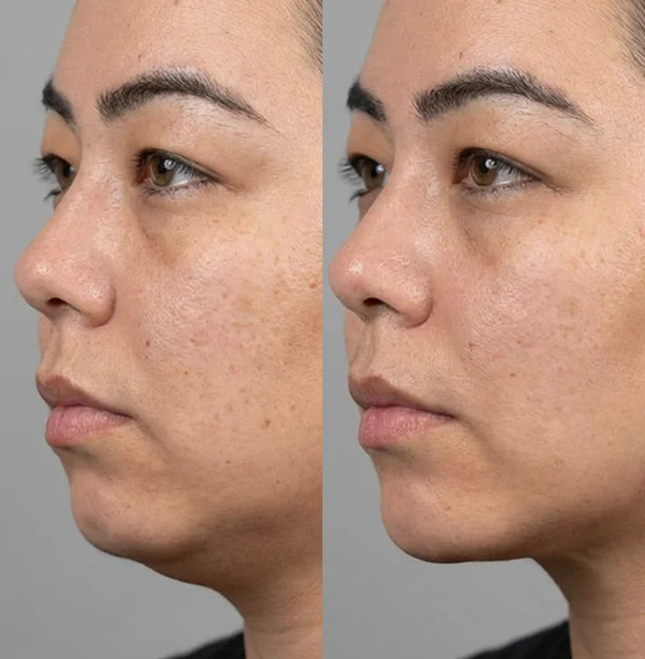 Yuna K., 36