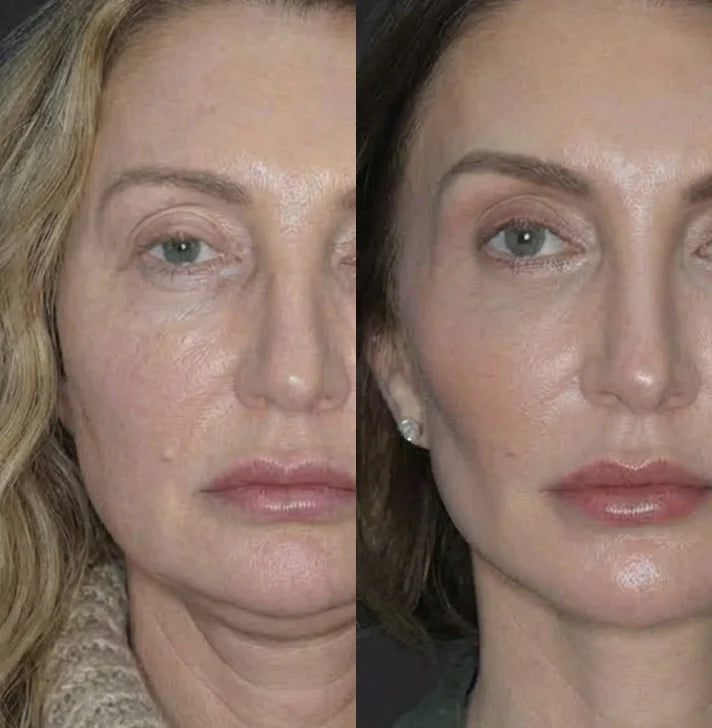 Andrea F, 49