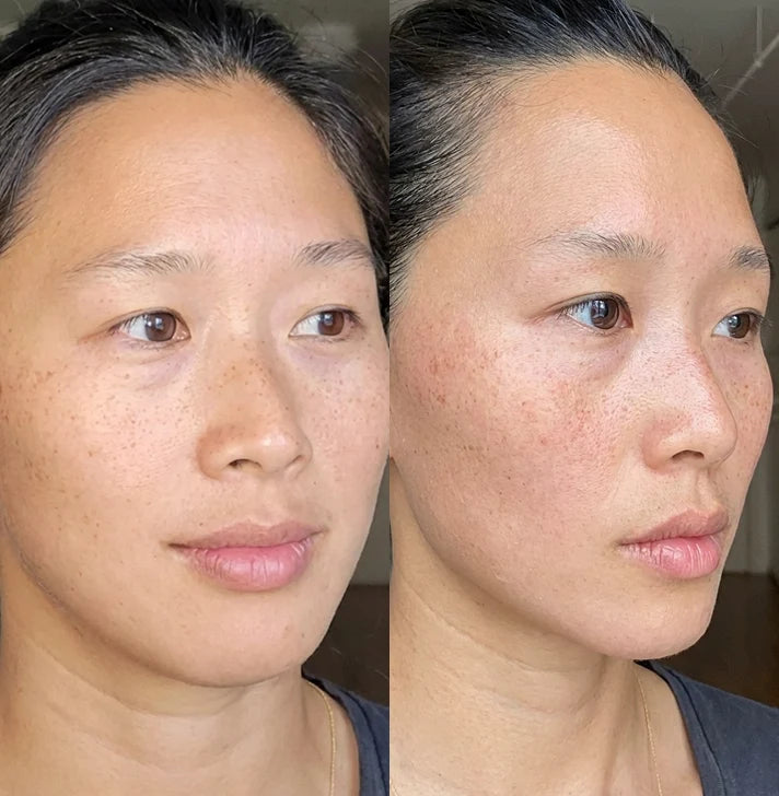 Mei, 35