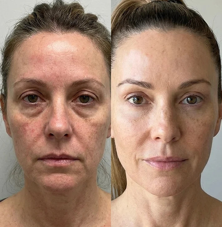 Laura H, 49