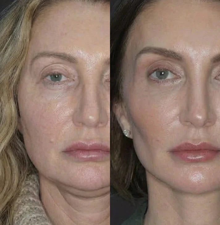 Andrea F, 49
