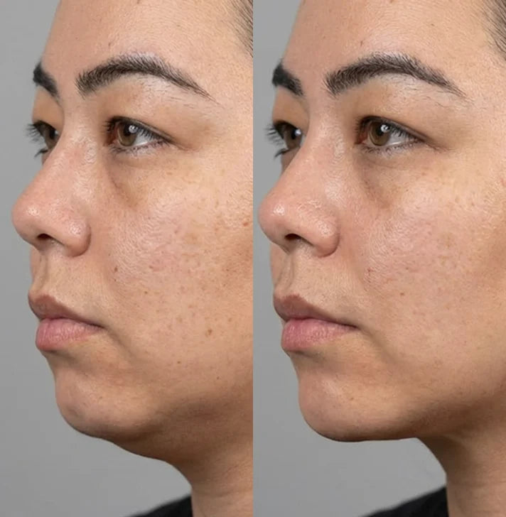 Yuna K, 36