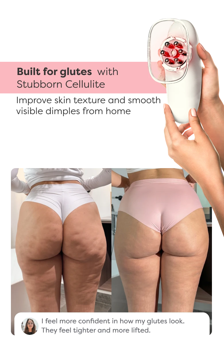 Before and after comparison showing visible improvement in glute contour and firmness after using Redu Sculpt.
