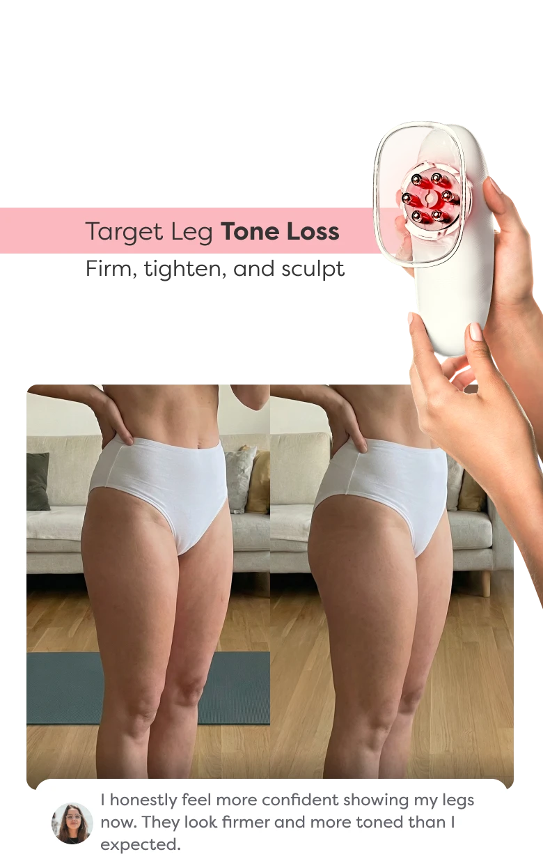Before and after comparison showing visible improvement in leg contour and skin appearance after using Redu Sculpt.