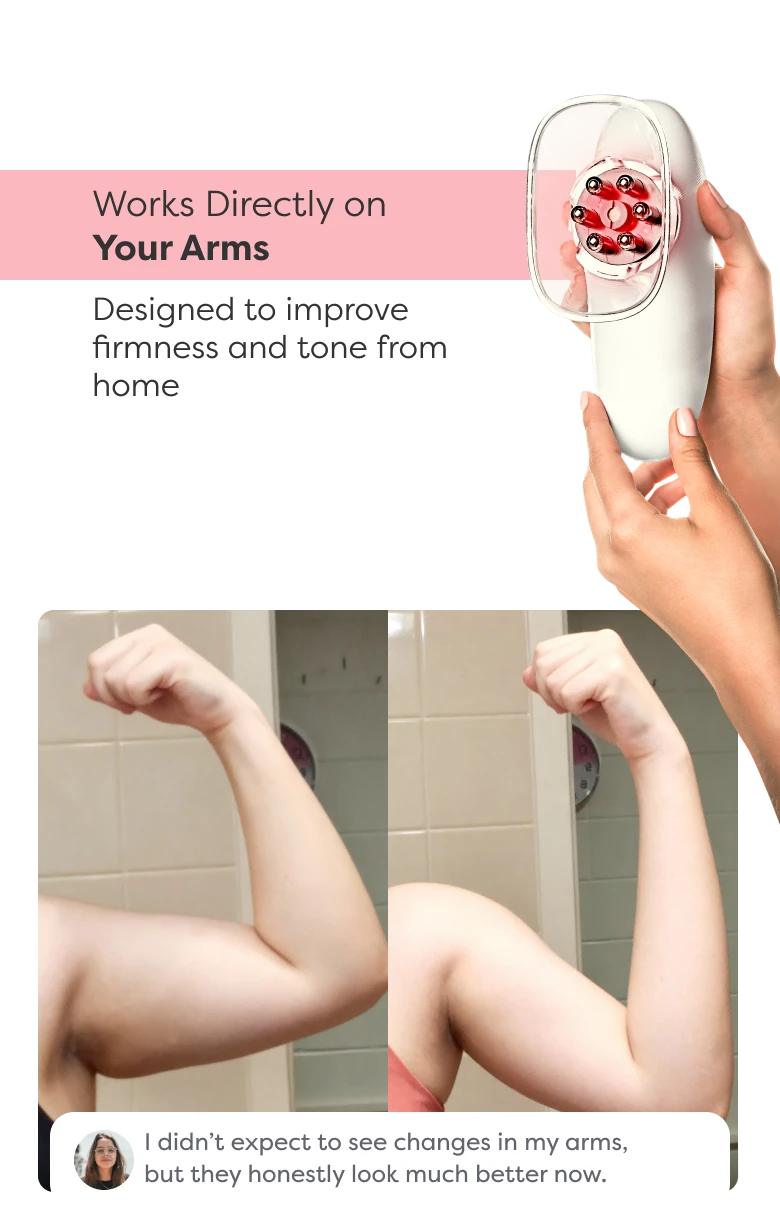 Before and after comparison showing visible improvement in arm contour and firmness after using Redu Sculpt.