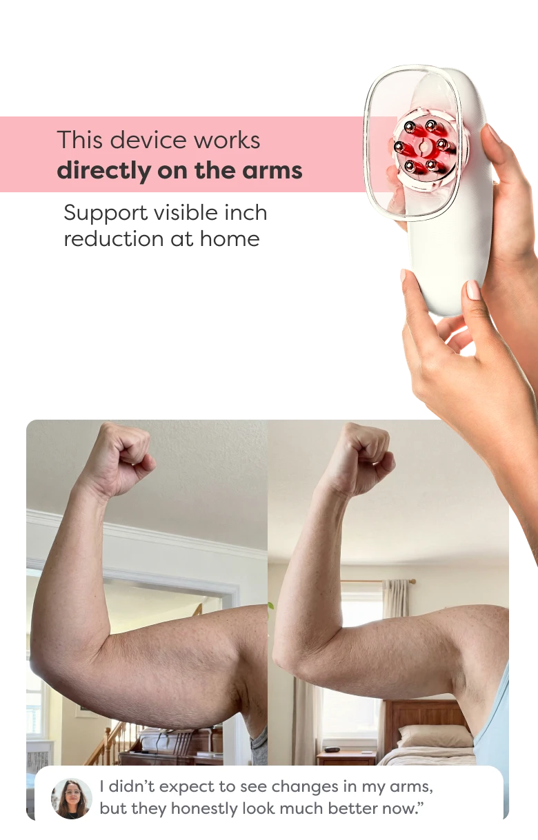 Before and after comparison showing visible improvement in arm contour and firmness after using Redu Sculpt.