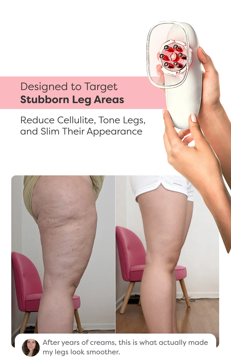 Before and after comparison showing visible improvement in leg contour and skin appearance after using Redu Sculpt.