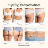 Redu Sculpt™ V.CF