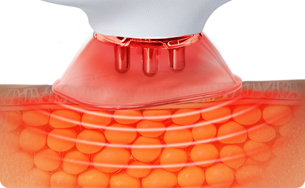 Red light therapy on the body designed to improve overall skin tone and quality.