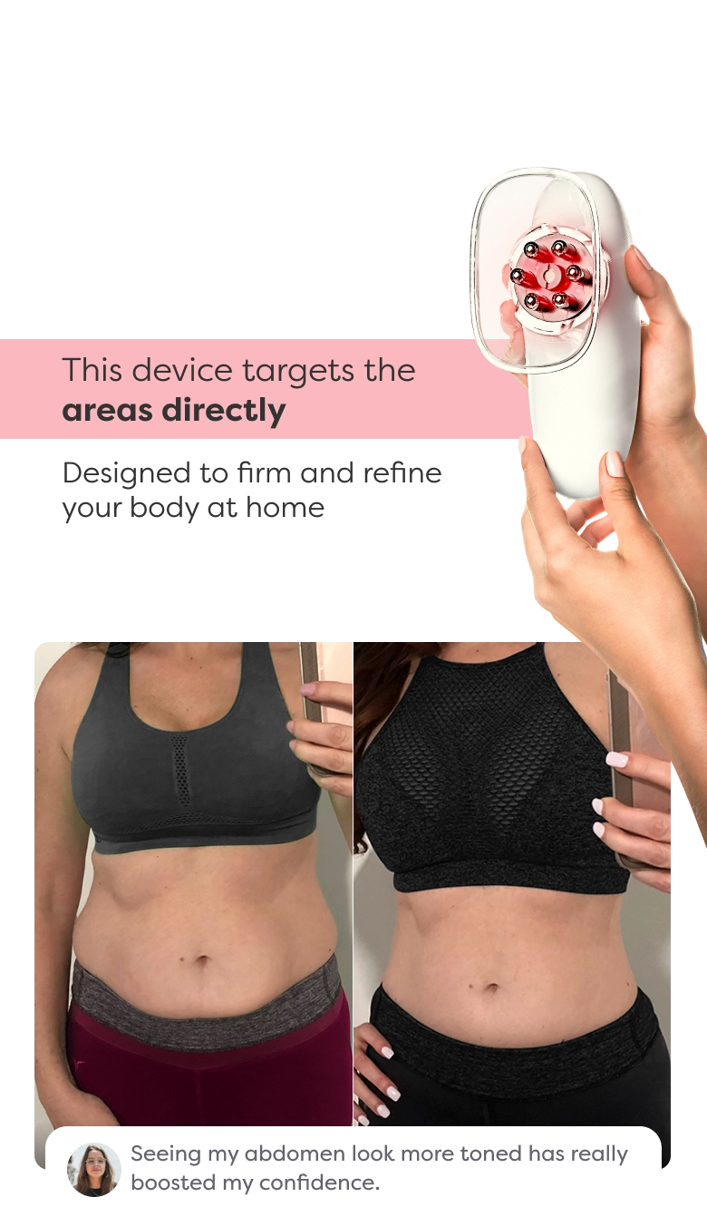 Before and after comparison showing visible improvement in arm contour and firmness after using Redu Sculpt.