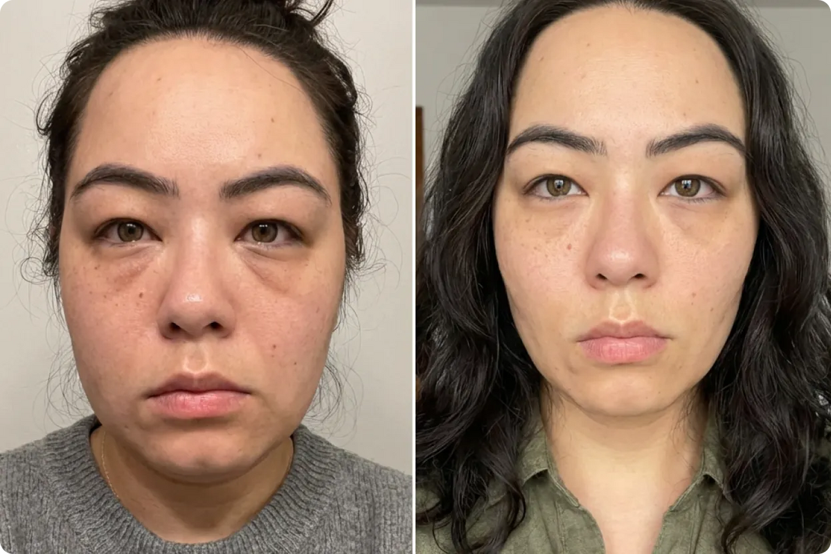Aya, 39