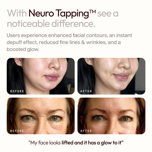 Illu Neuro Tapping
