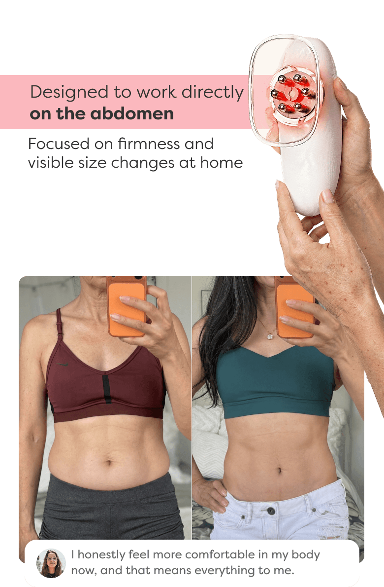 Before and after comparison showing visible improvement in abdominal contour and firmness after using Redu Sculpt.