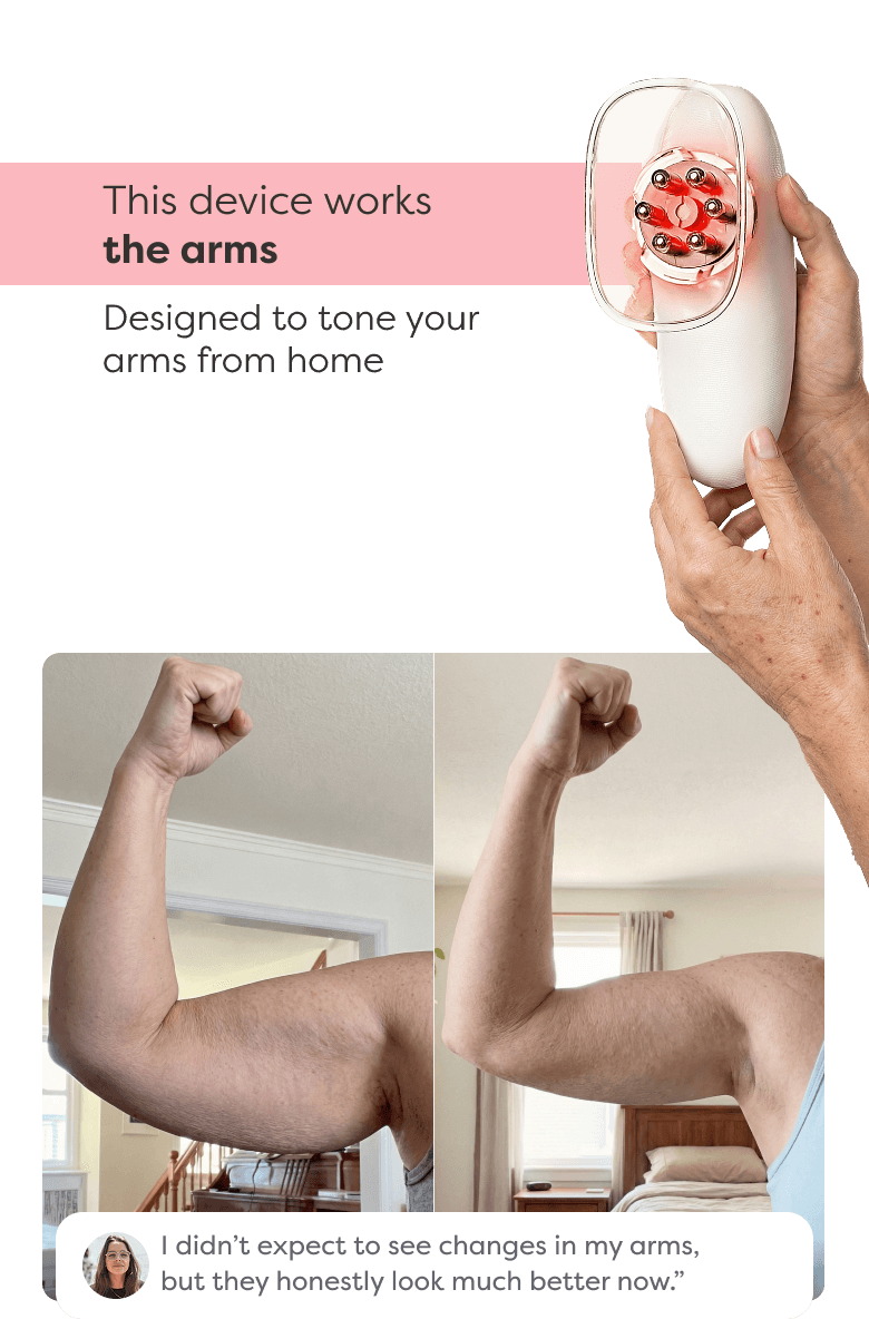 Before and after comparison showing visible improvement in arm contour and firmness after using Redu Sculpt.