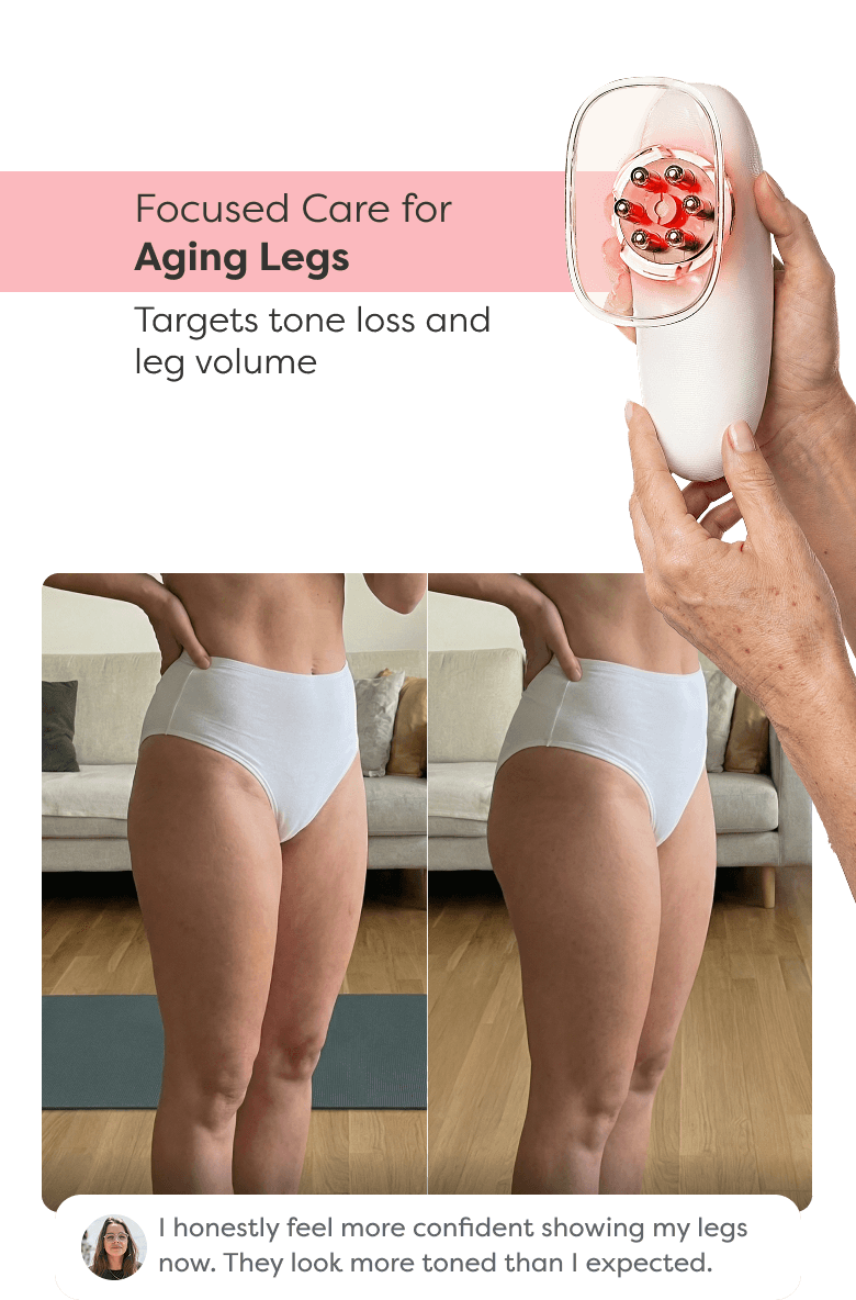 Before and after comparison showing visible improvement in leg contour and skin appearance after using Redu Sculpt.